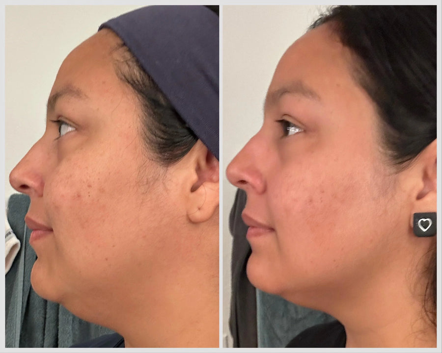 Customer before and after result