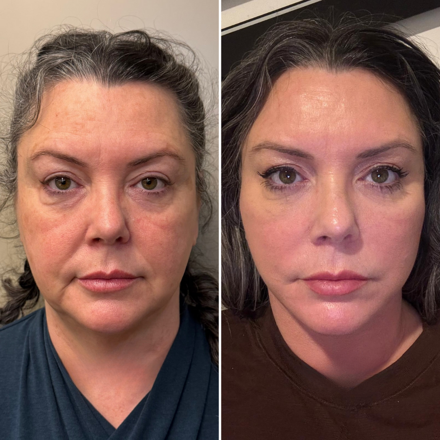 Customer before and after result