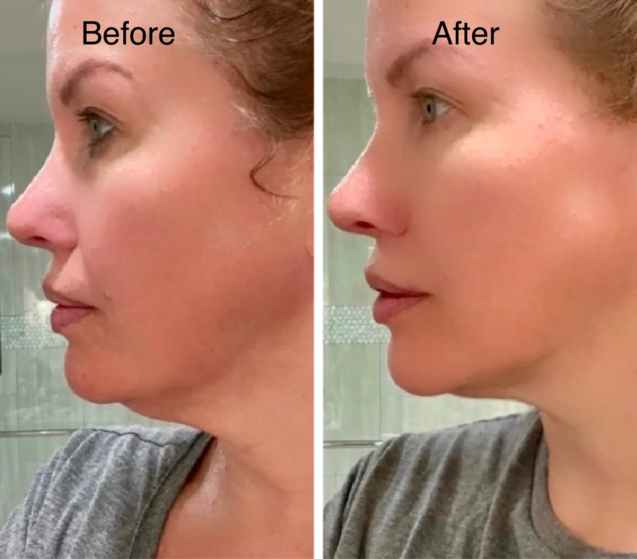 Customer before and after result